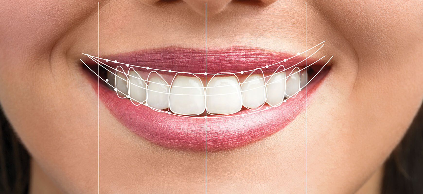 Kozmetik Diş Hekimliği